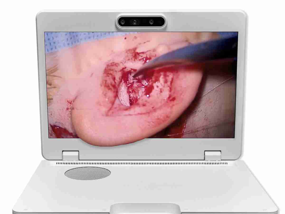 达擎之＂Heads-up 3D显微手术显示系统＂，，，，整合4K裸眼3D显示及眼球追踪系统，，，具备快速追踪人眼移动位置功能，，，减轻医师长时间维持固定姿势的负担，，，，让医师能有更宽广清晰的3D立体视野及更舒适的姿势来执行手术。。。。